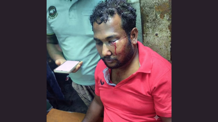 বোয়ালমারীতে সাতৈর-এলাংখালী রোডে ডাকাতের হামলায় এক যুবক আহত